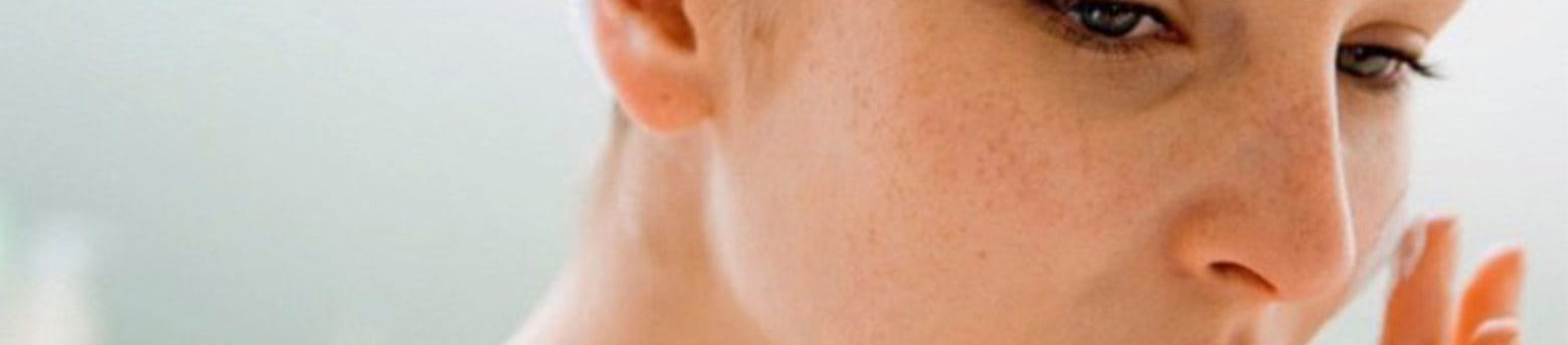 da bị nám nhẹ