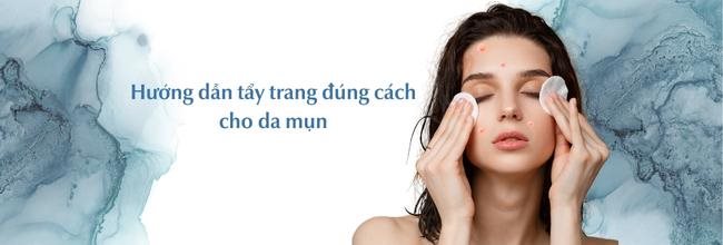 Tẩy trang đúng cách cho da mụn hiệu quả nhất