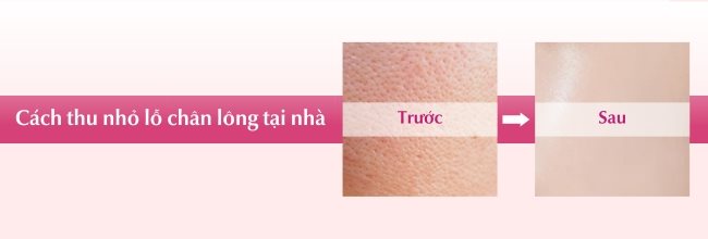 Cách thu nhỏ lỗ chân lông