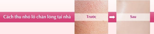 Cách thu nhỏ lỗ chân lông