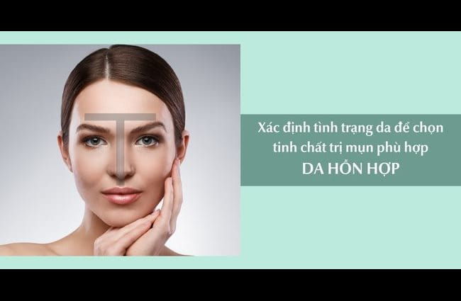 Da hỗn hợp thường có tình trạng đổ dầu ở vùng chữ T và khô căng các vùng da còn lại
