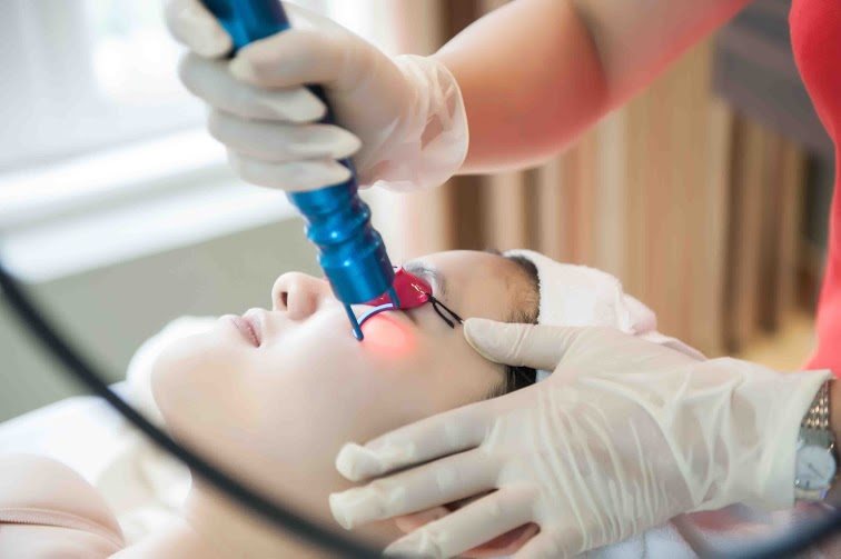 cách trị vết thâm sau khi bắn laser
