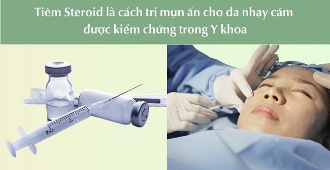 Tiêm Steroid là cách trị mụn ẩn cho da nhạy cảm hiện đại, được kiểm chứng trong Y khoa