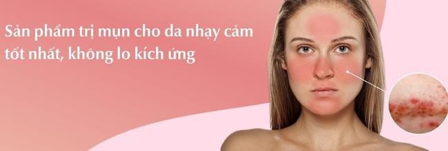 Sản Phẩm Trị Mụn Cho Da Nhạy Cảm