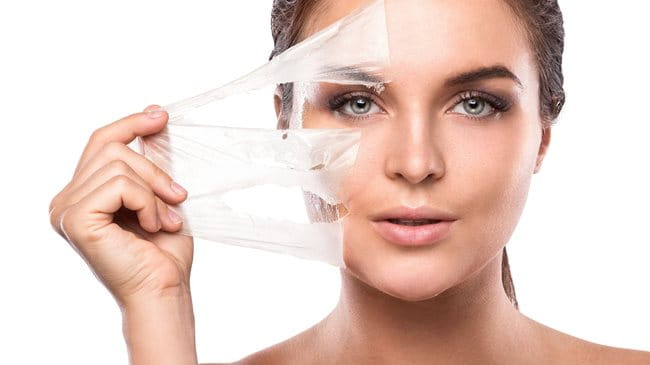 Sử dụng sản phẩm peel da cũng là một gợi ý giúp bạn trị thâm mụn