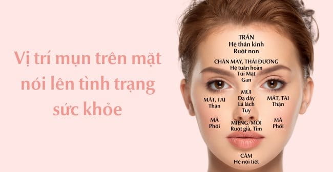 Mụn mọc ở trán và thái dương: Nguyên nhân, dấu hiệu và cách khắc phục hiệu quả