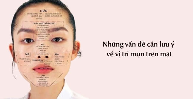 Những vấn đề cần lưu ý về vị trí mụn trên mặt