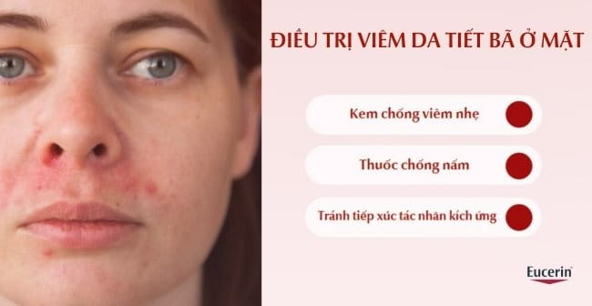 Cách trị viêm da tiết bã ở mặt