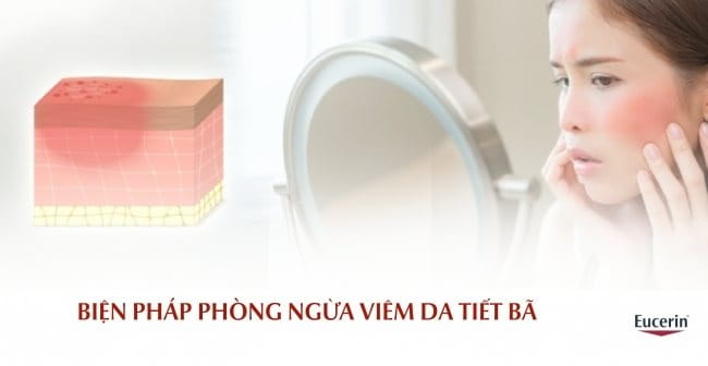 Biện pháp phòng ngừa viêm da tiết bã