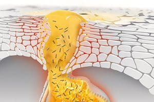 What causes blackheads, whiteheads and pimples and how does acne develop?
