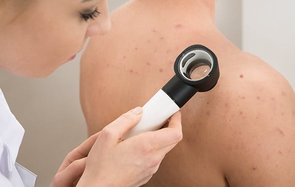 rutina acne