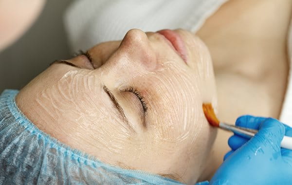 Chemisches Peeling wird im Gesicht einer Frau aufgetragen