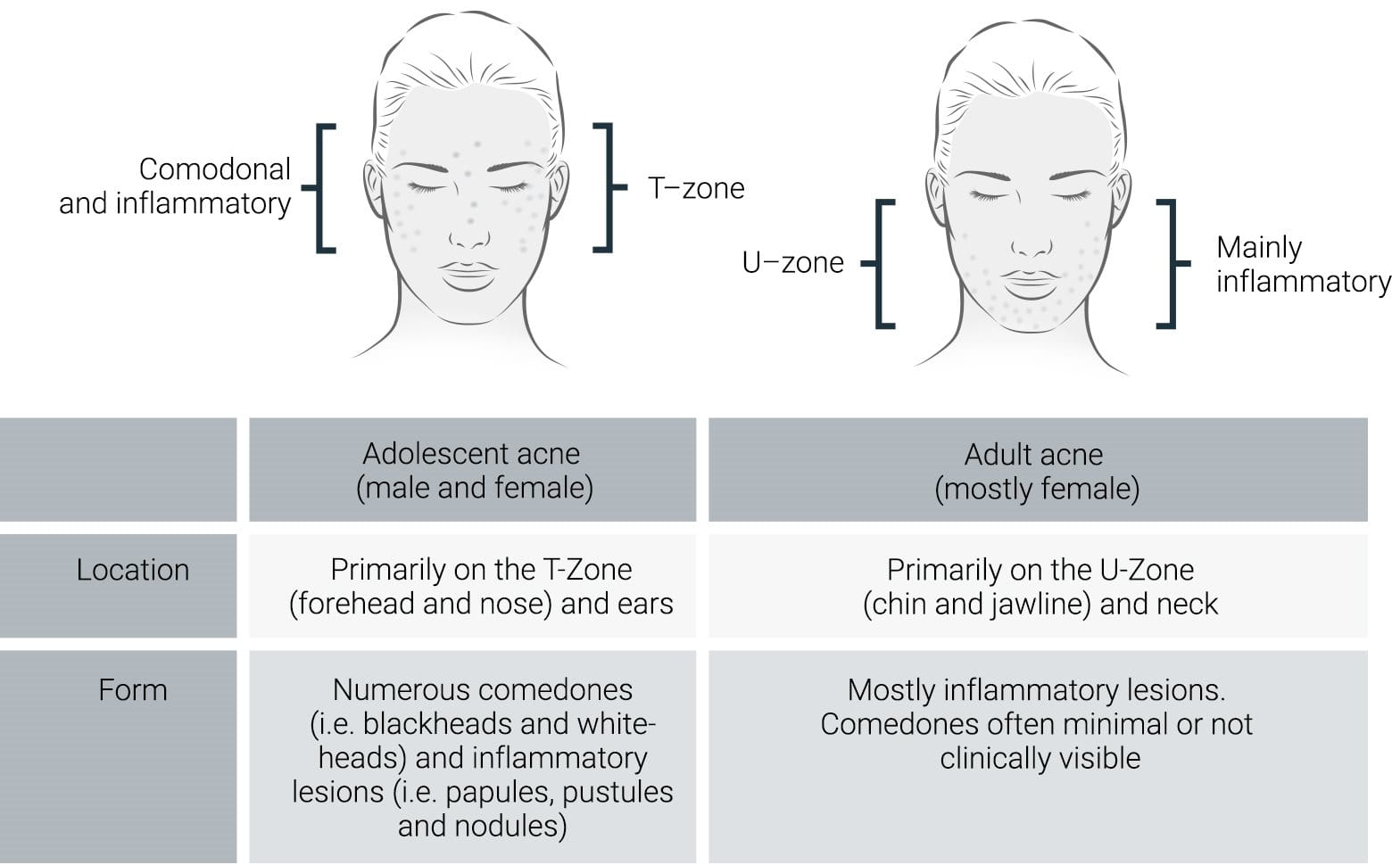 EUC-INT_DERMOPURE_220_acne-tarda_image_normal_02