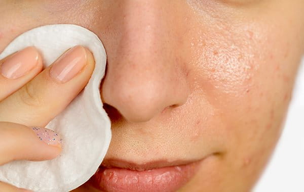 Rimuovere il make-up aiuta a prevenire le imperfezioni e acne