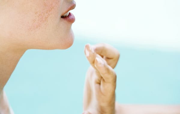 Coloro che si stanno sottoponendo ad un trattamento per l'acne dovrebbero usare la protezione solare quotidianamente 