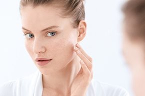 Blemish- and acne-prone skin: causes, triggers, symptoms and advice