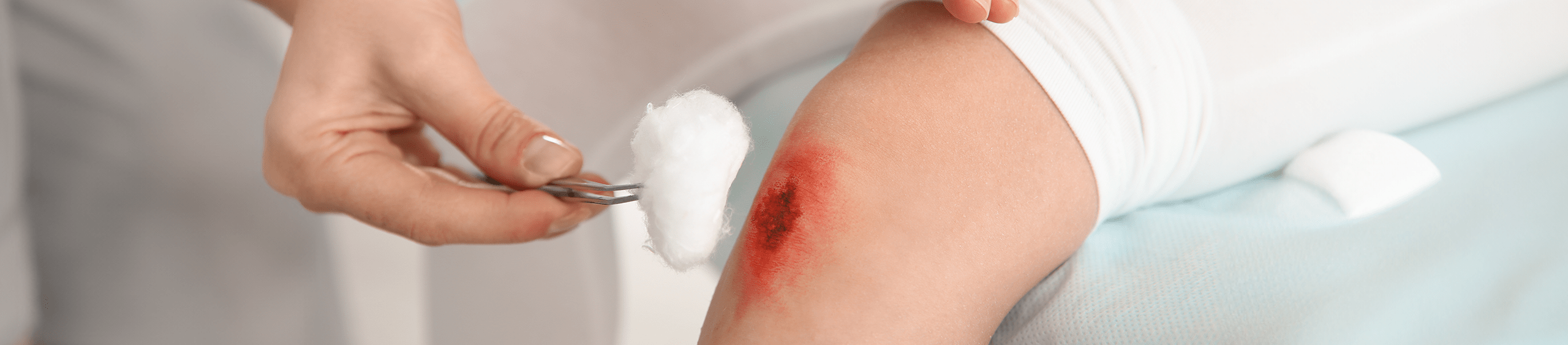 persona con una herida en la piel