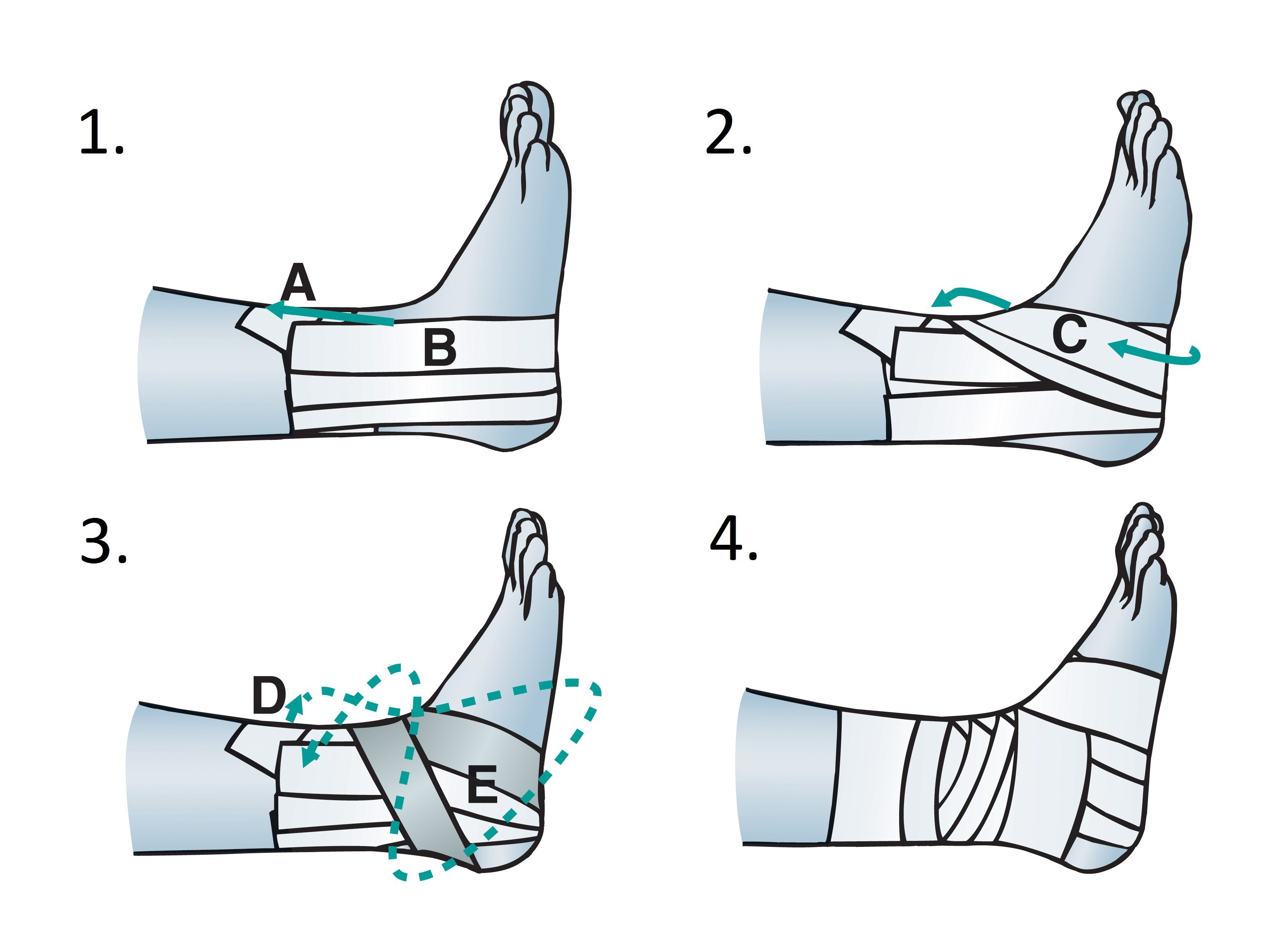 Treating A Rolled Ankle Or Sprain | Elastoplast