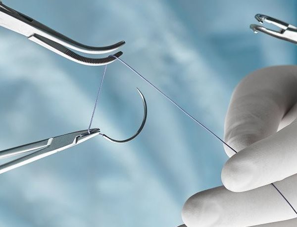 Nahaufnahme einer Hand mit sterilem weißem Handschuh, die Nadel und Faden zur Wundschließung hält.