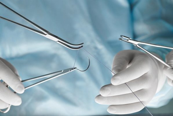 Chirurgenhände mit OP Besteck