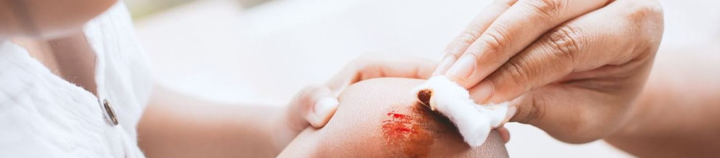 Wundarten wie Schüfwunden am Knie erkennen und richtig behandeln