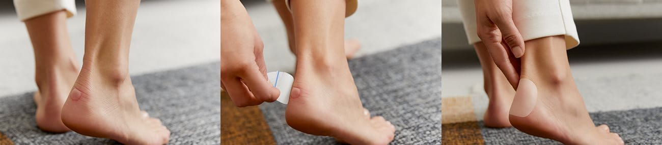 Opi paras rakon ja hiertymän hoito