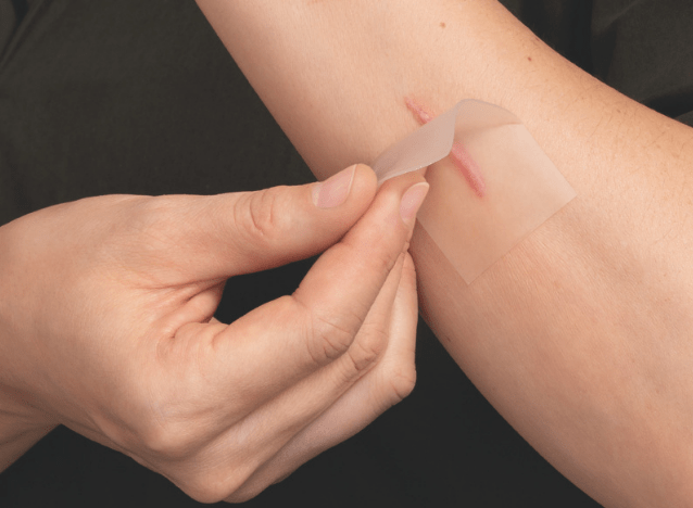 surgical scar across abdomen