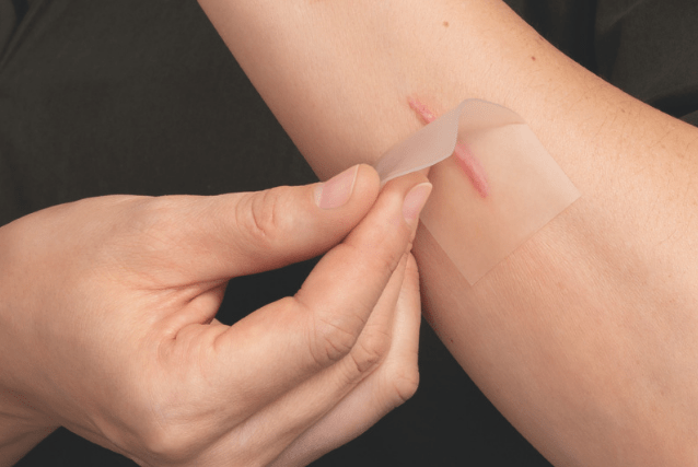 surgical scar across abdomen