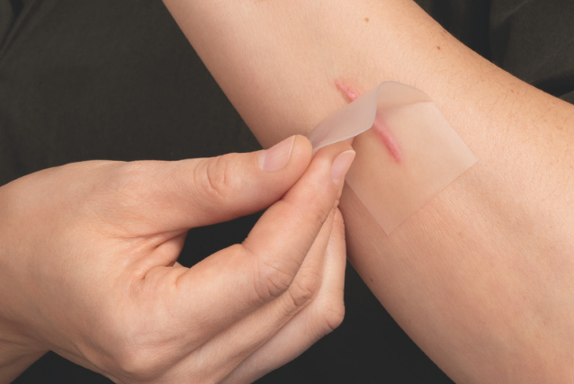 surgical scar across abdomen