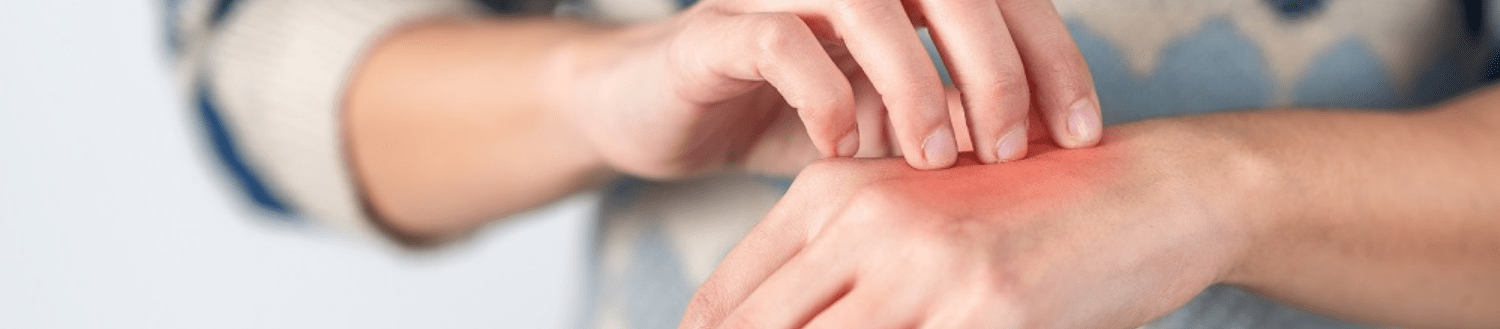 person scratching an itchy healing wound