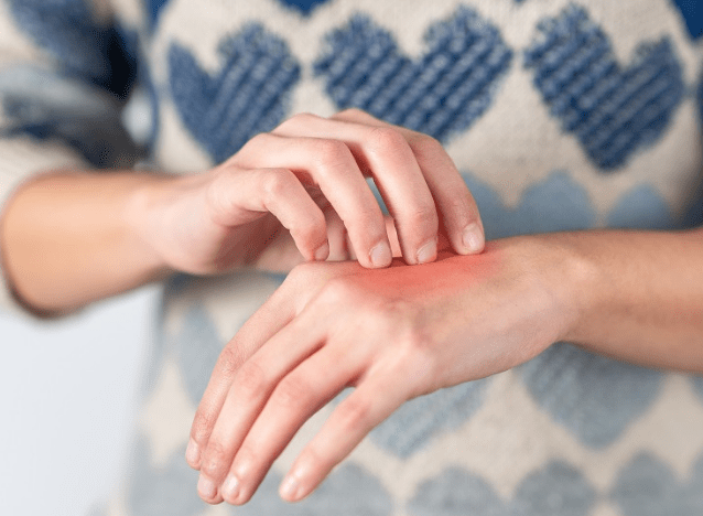 red skin from infected cut