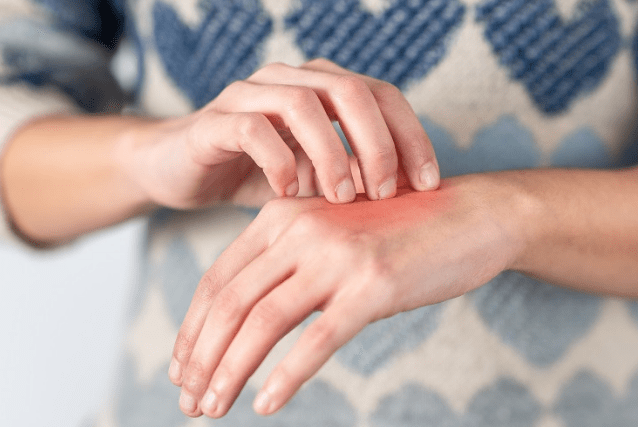 red skin from infected cut