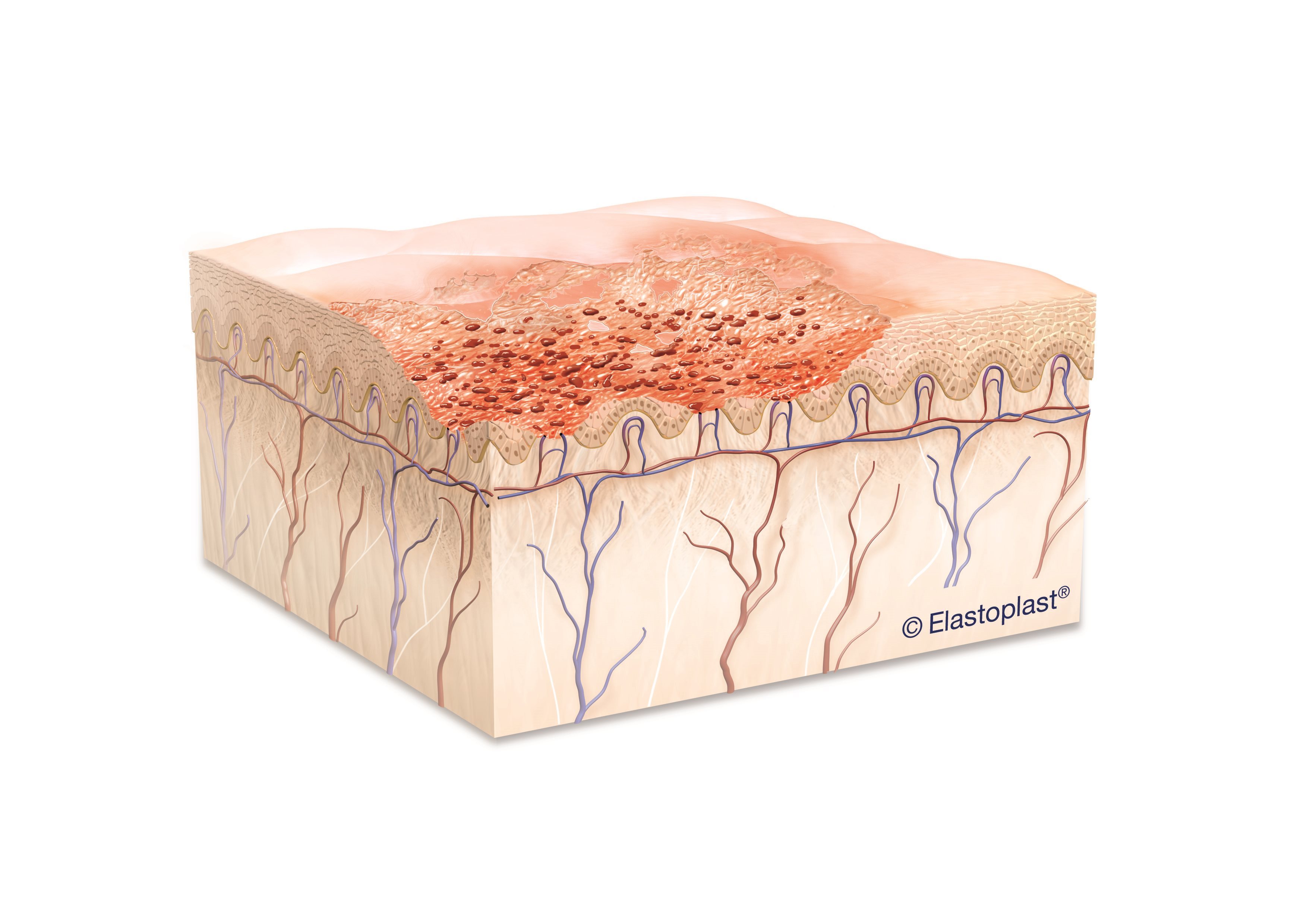Cuts and Grazes | Wound Healing | Elastoplast UK