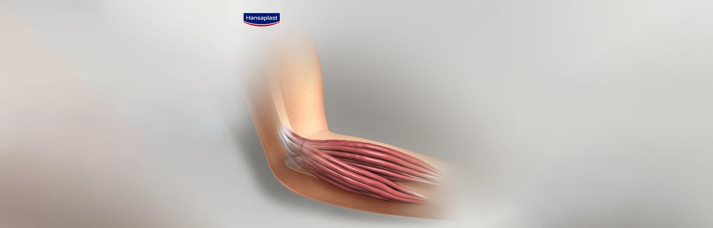 epikondylitida-agkwna