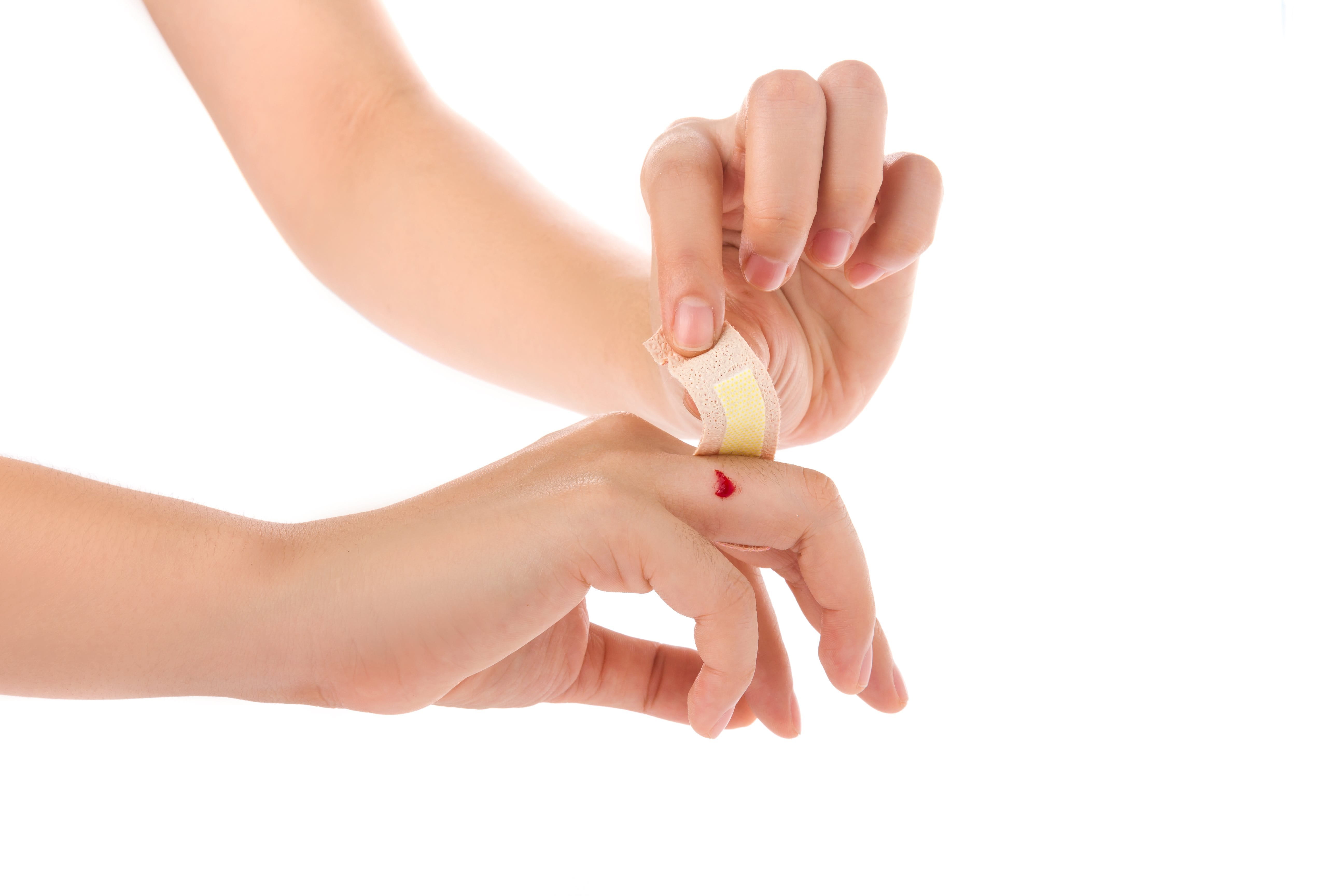 Perawatan luka terbuka agar tidak semakin parah.