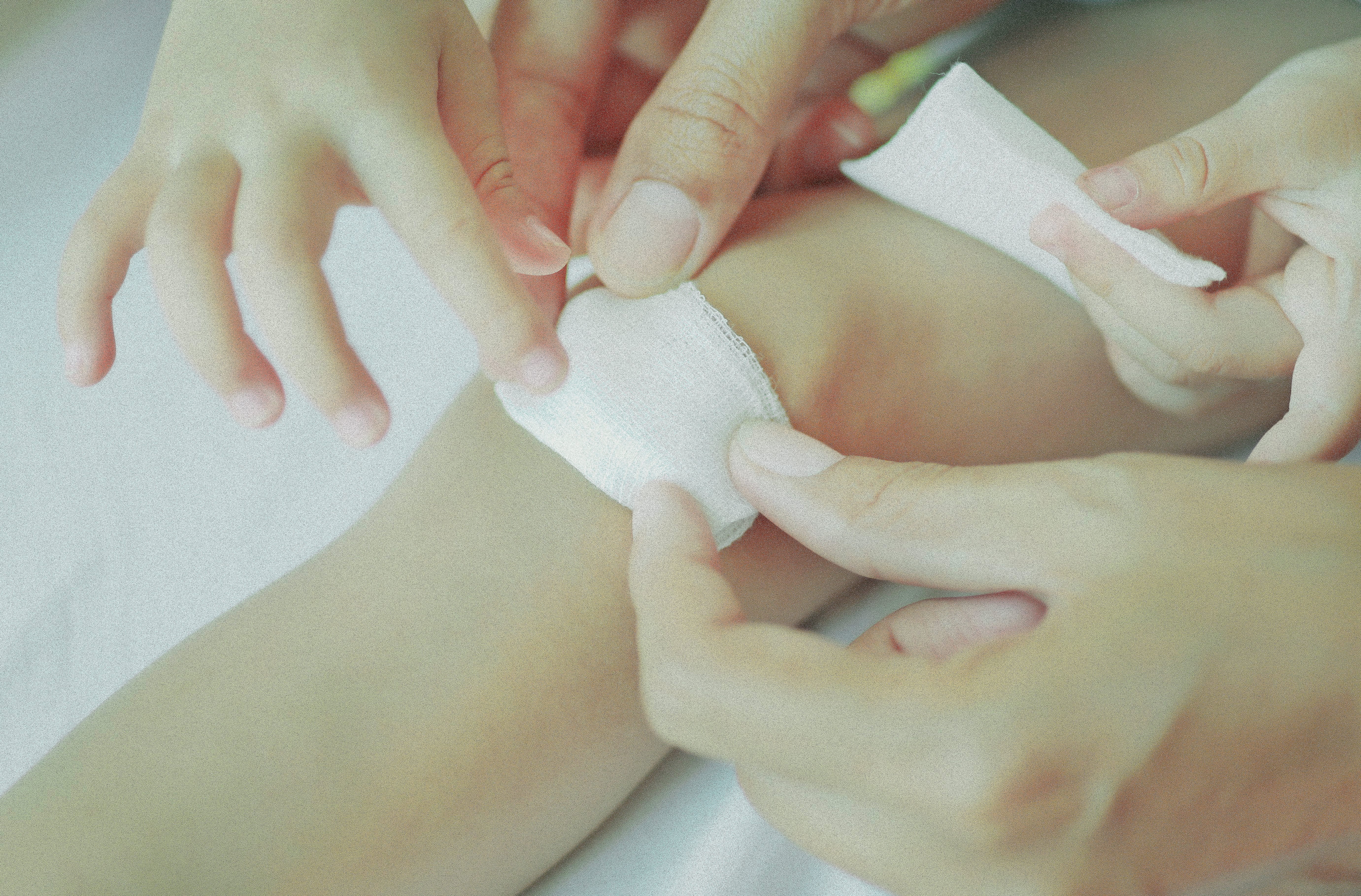 Cara mengobati luka goresan di kaki