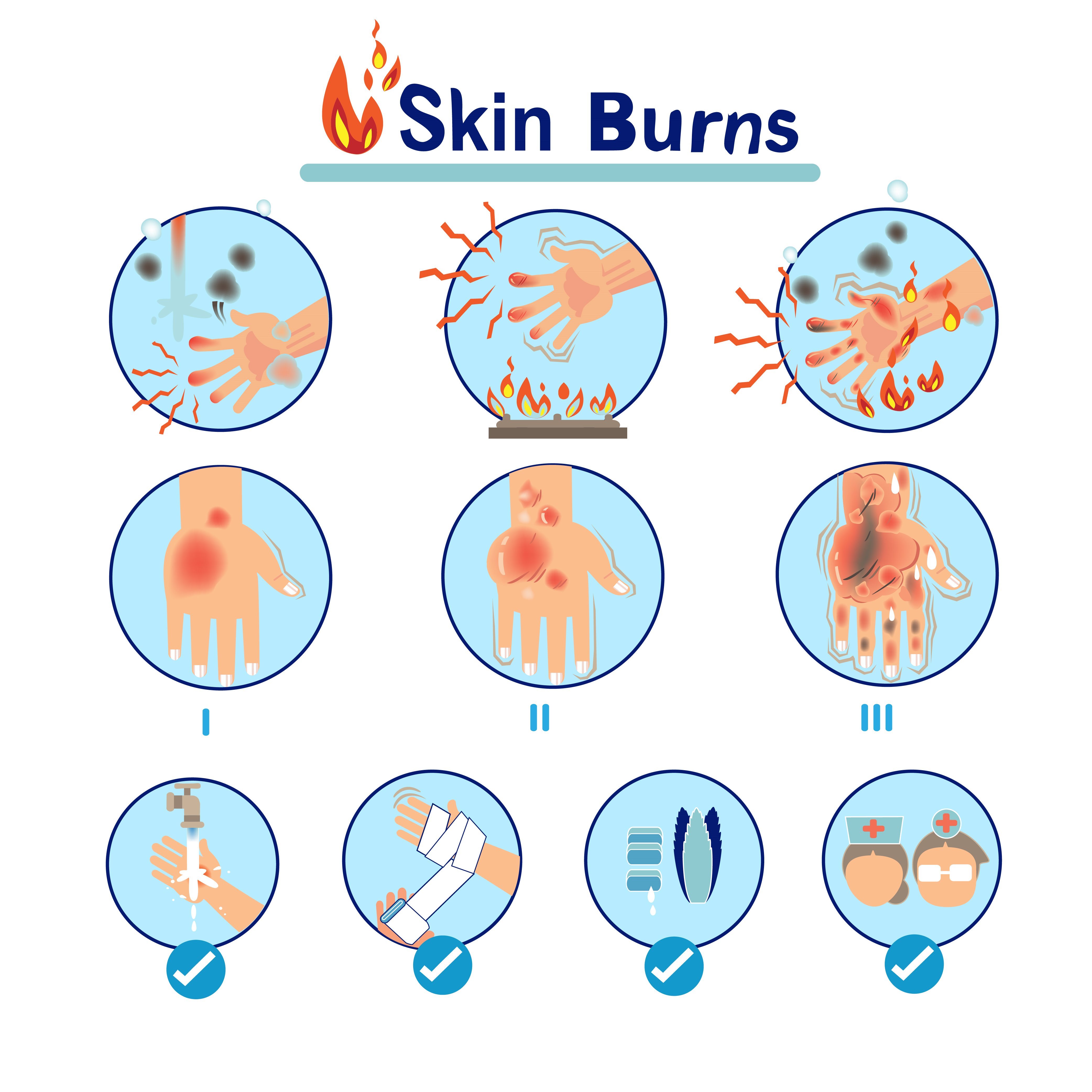 Apa yang harus dilakukan jika tangan kena uap panas