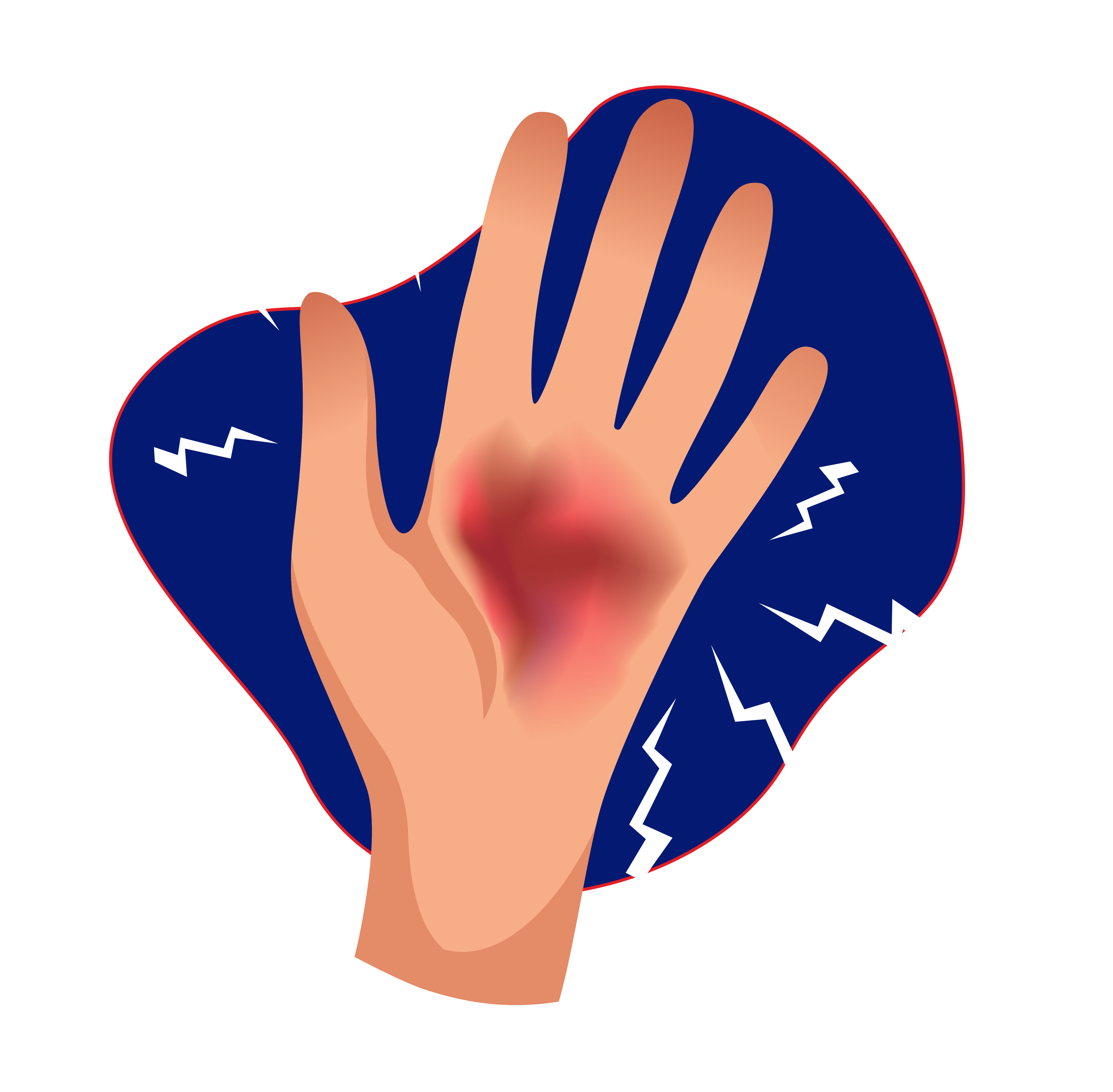 Tanda-tanda infeksi yang memerah