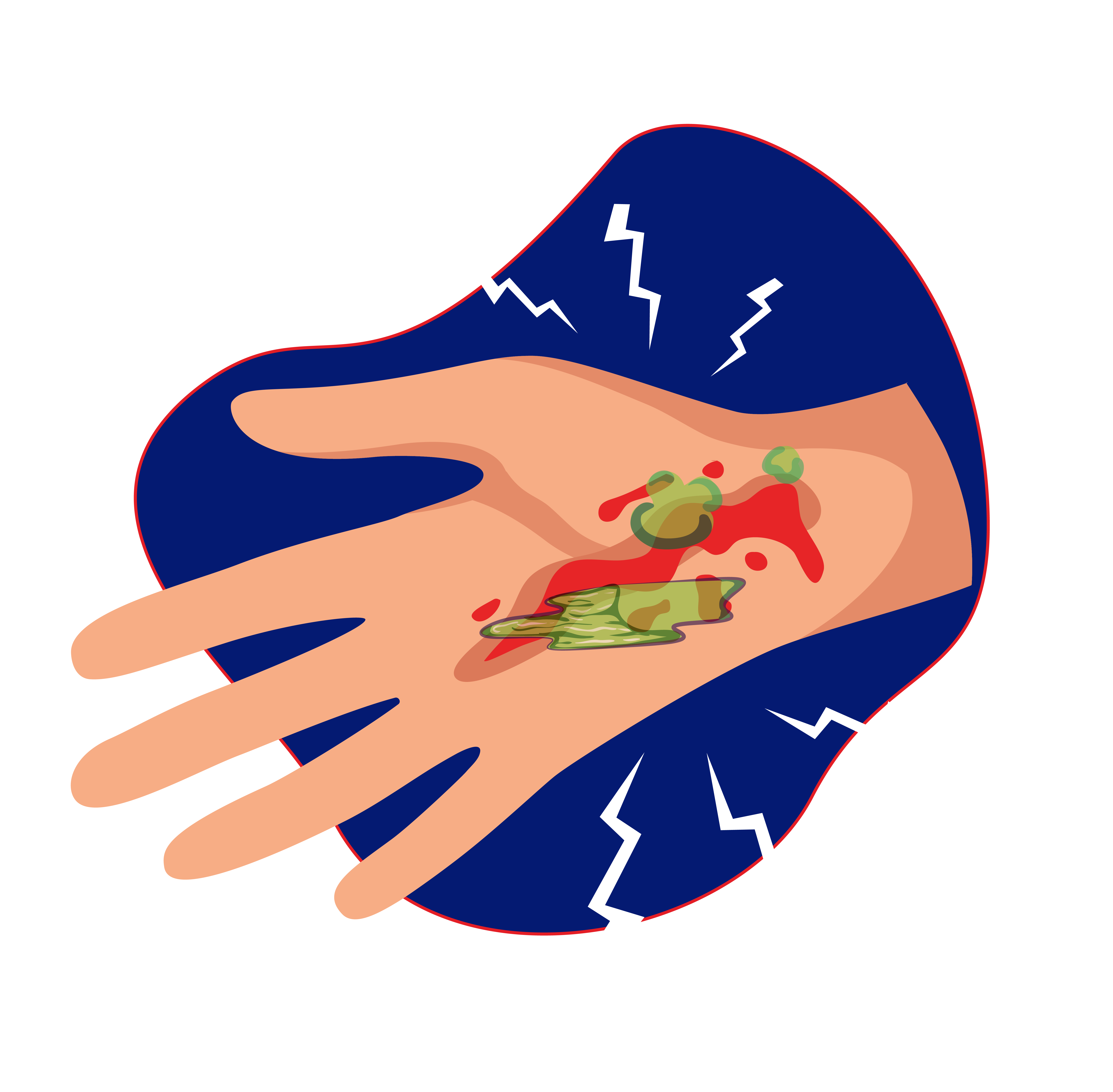 Luka bernanah adalah tanda-tanda infeksi