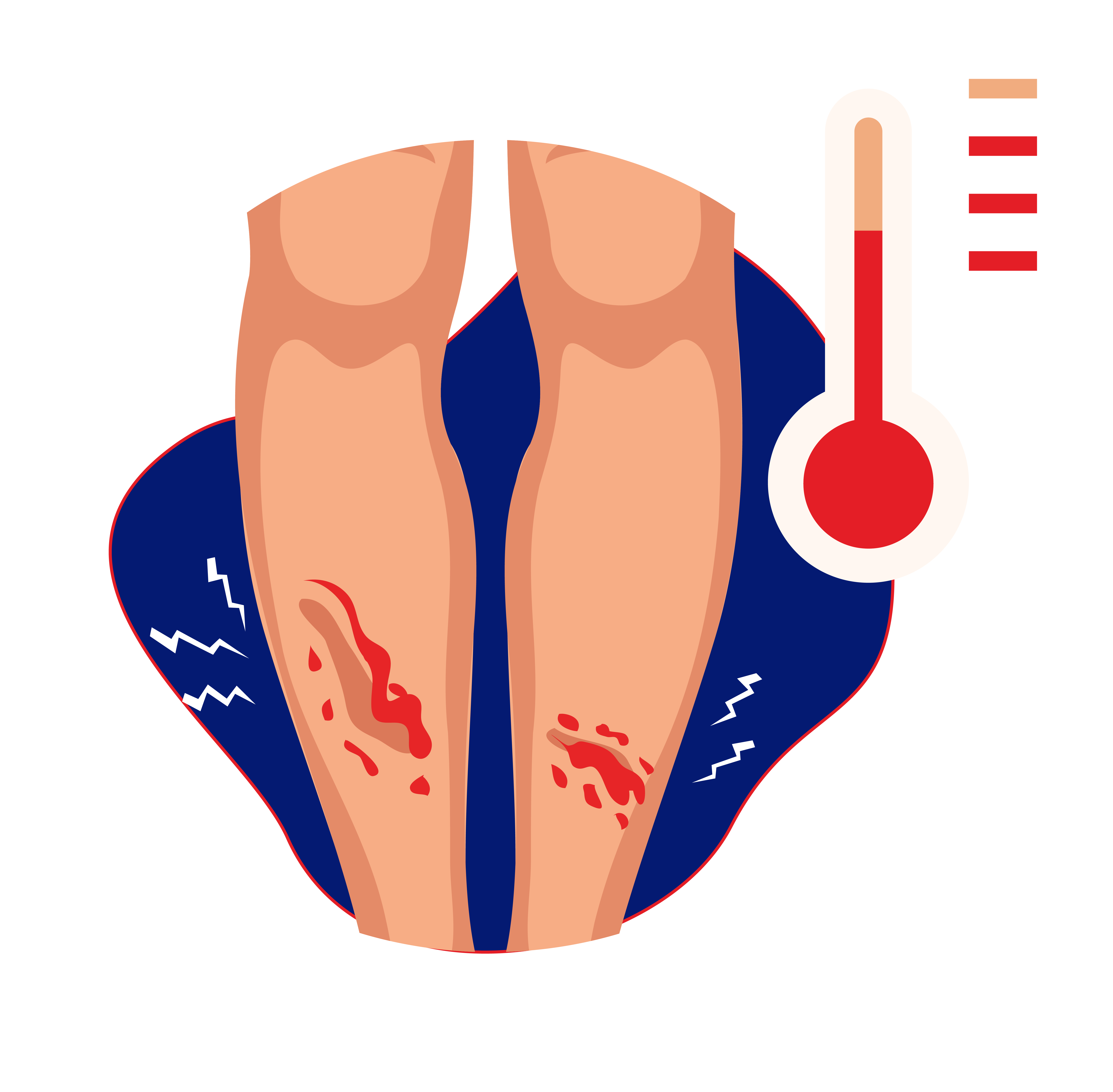 Tanda-tanda infeksi berupa demam
