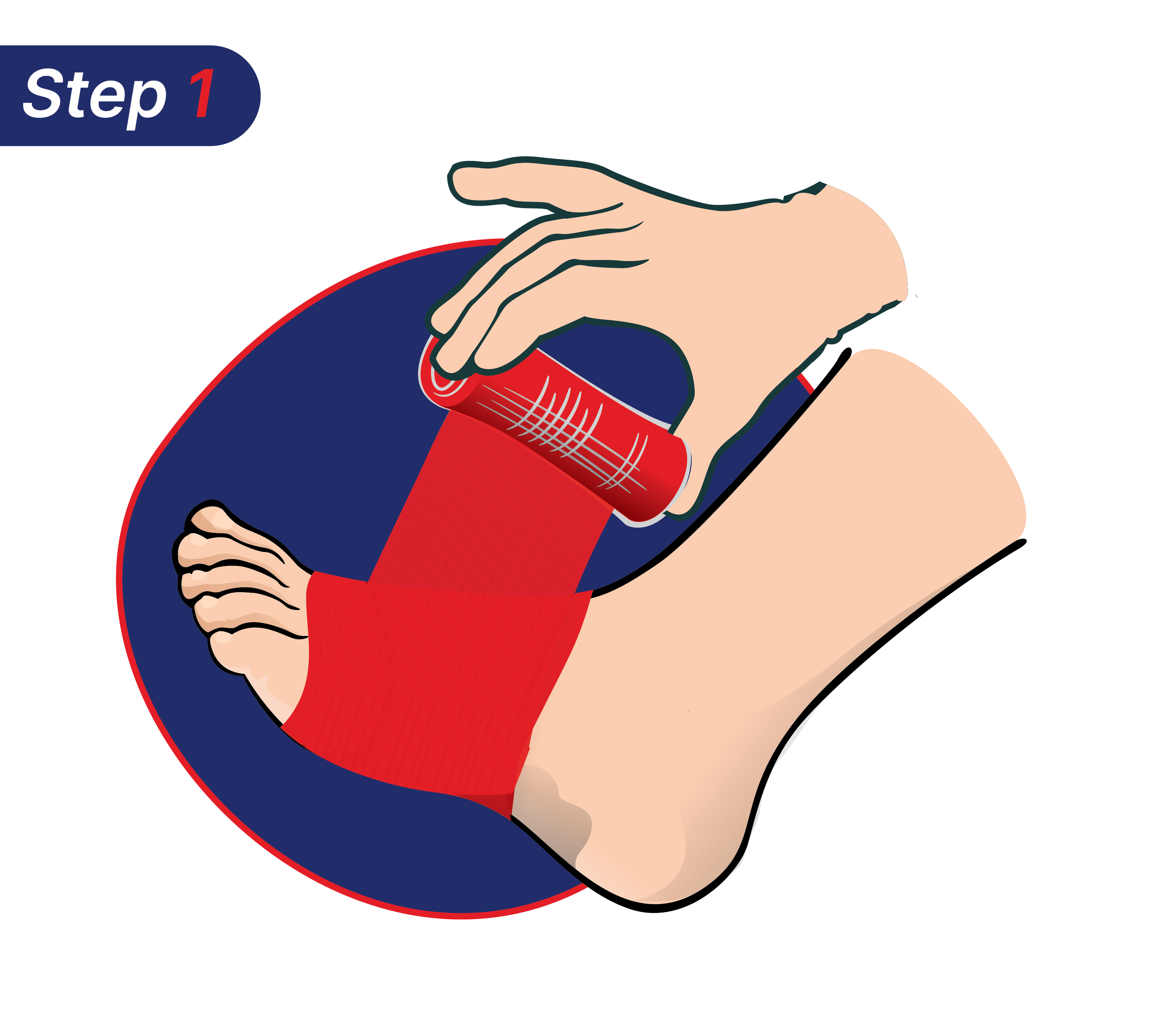 Cara mengatasi kaki terkilir dengan Hansaplast.