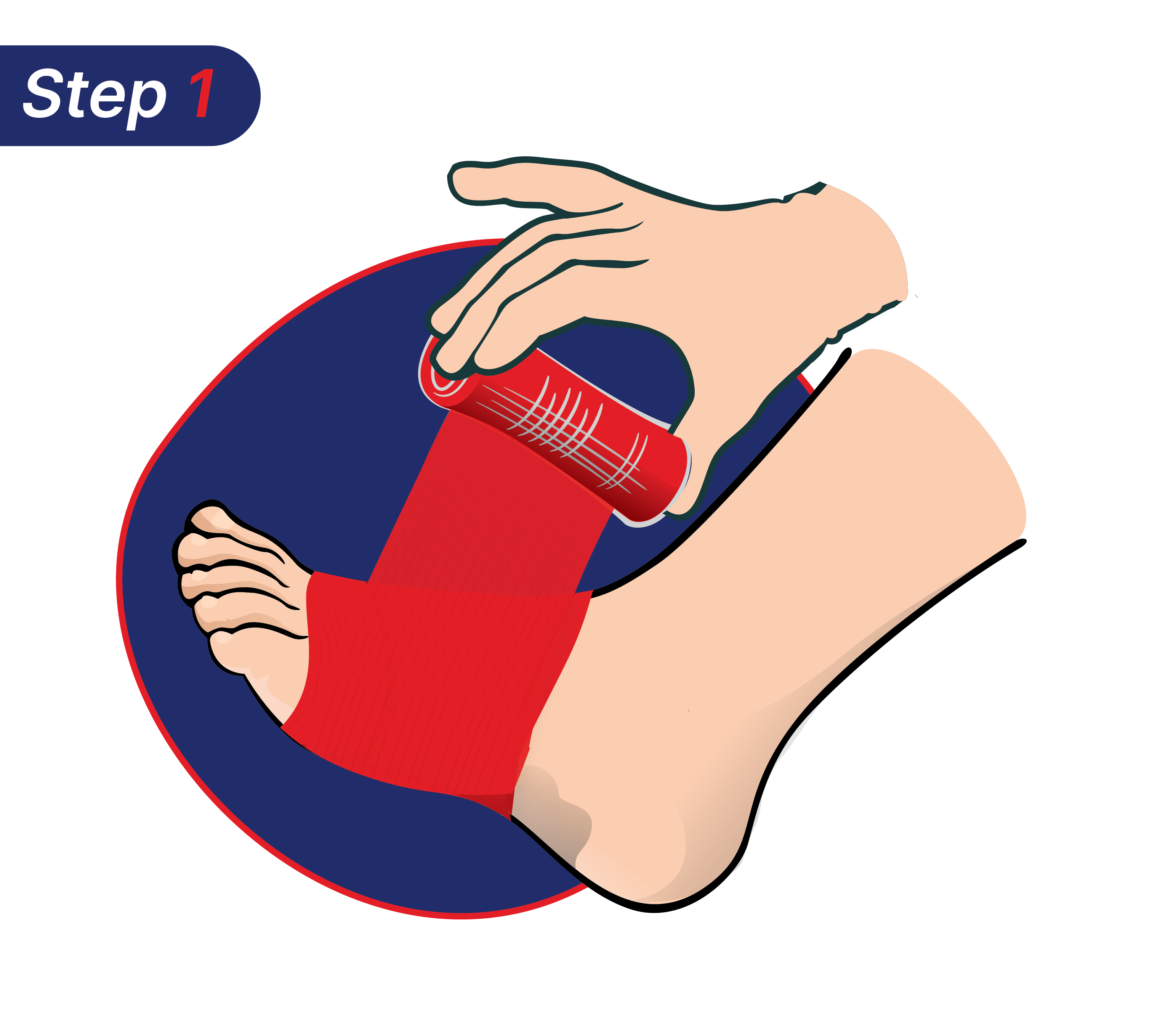 Cara mengatasi kaki terkilir dengan Hansaplast.