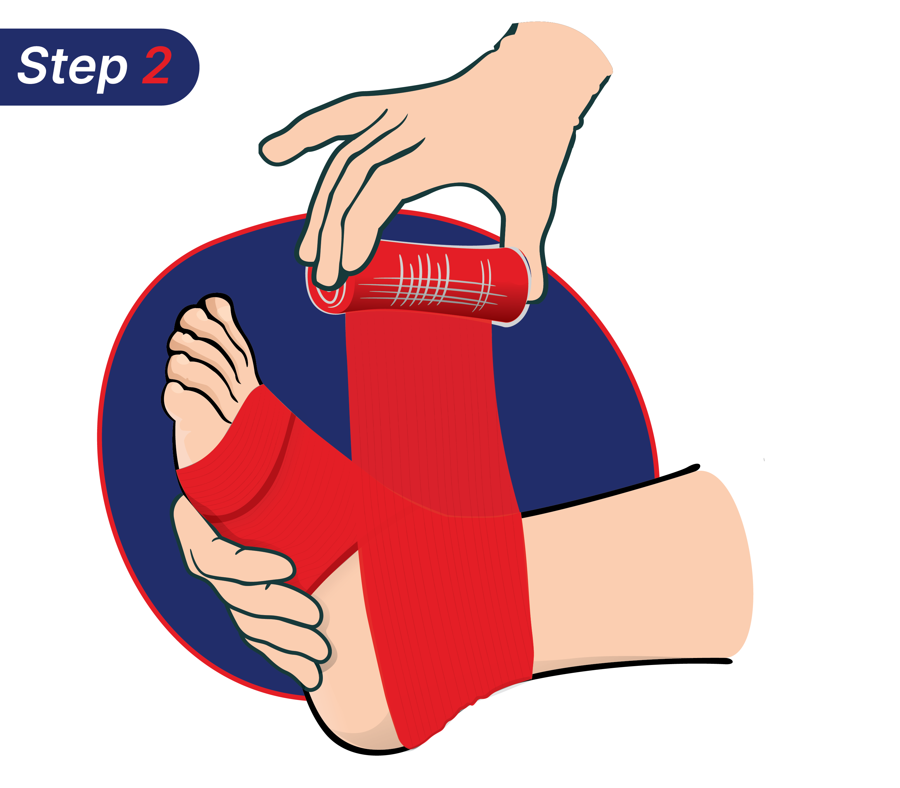 Langkah cara mengatasi kaki terkilir dengan Hansaplast.