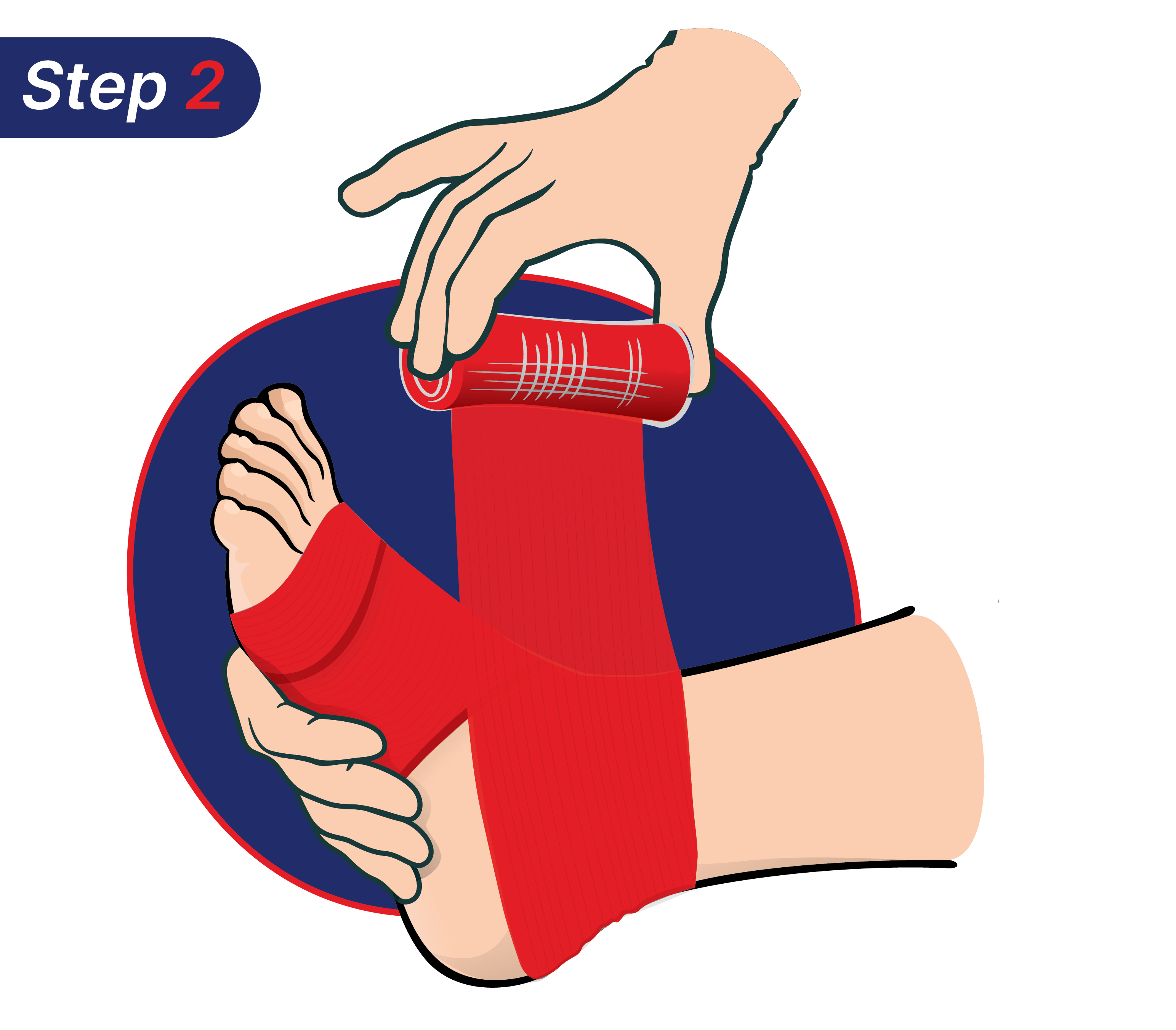 Langkah cara mengatasi kaki terkilir dengan Hansaplast.