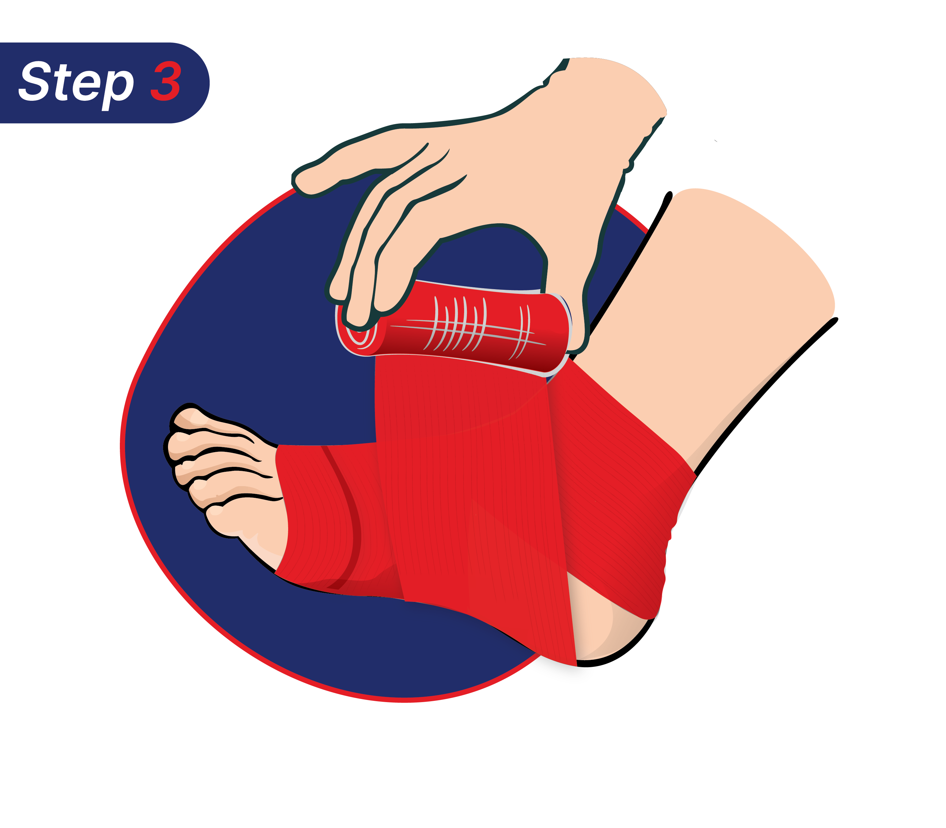 Cara mengatasi kaki terkilir dengan membalutnya.