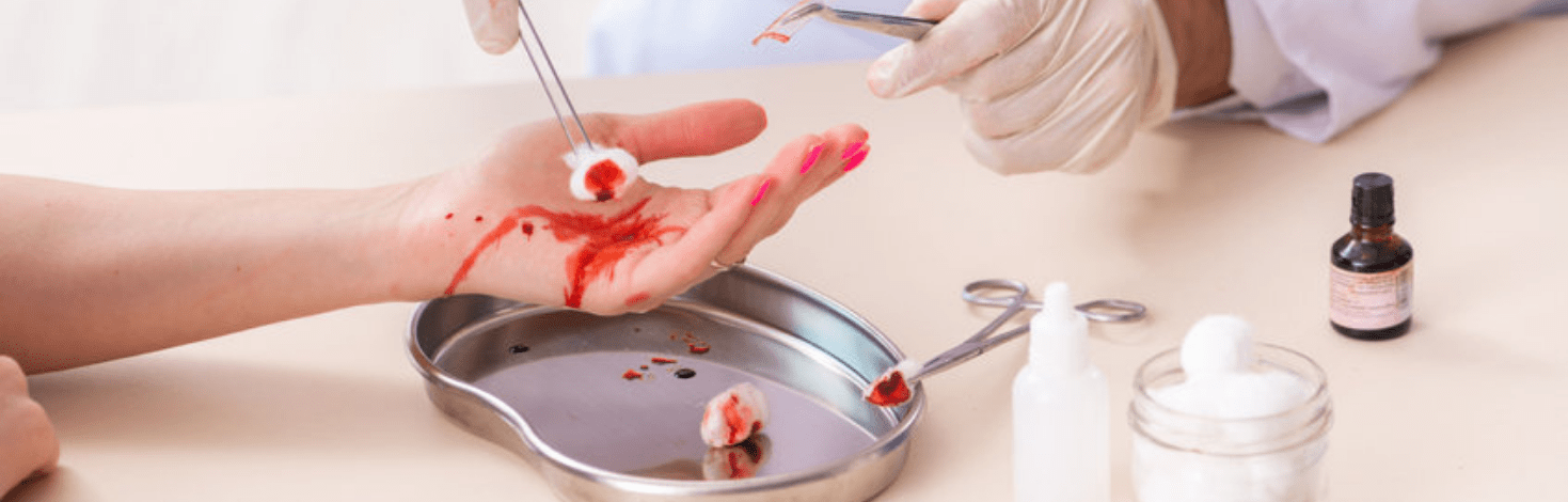 Perawatan luka terbuka sangat penting diketahui.