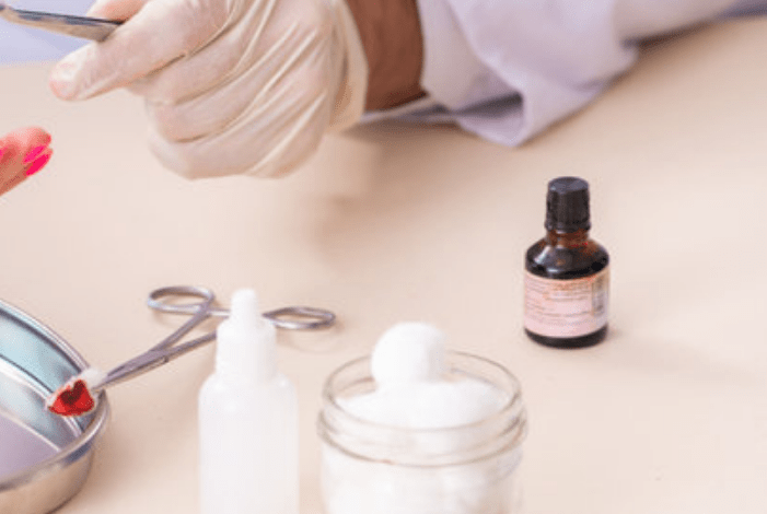 Perawatan luka terbuka sangat penting diketahui.