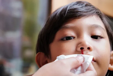 Leukimia bisa jadi salah satu faktor penyebab nyeri otot pada anak