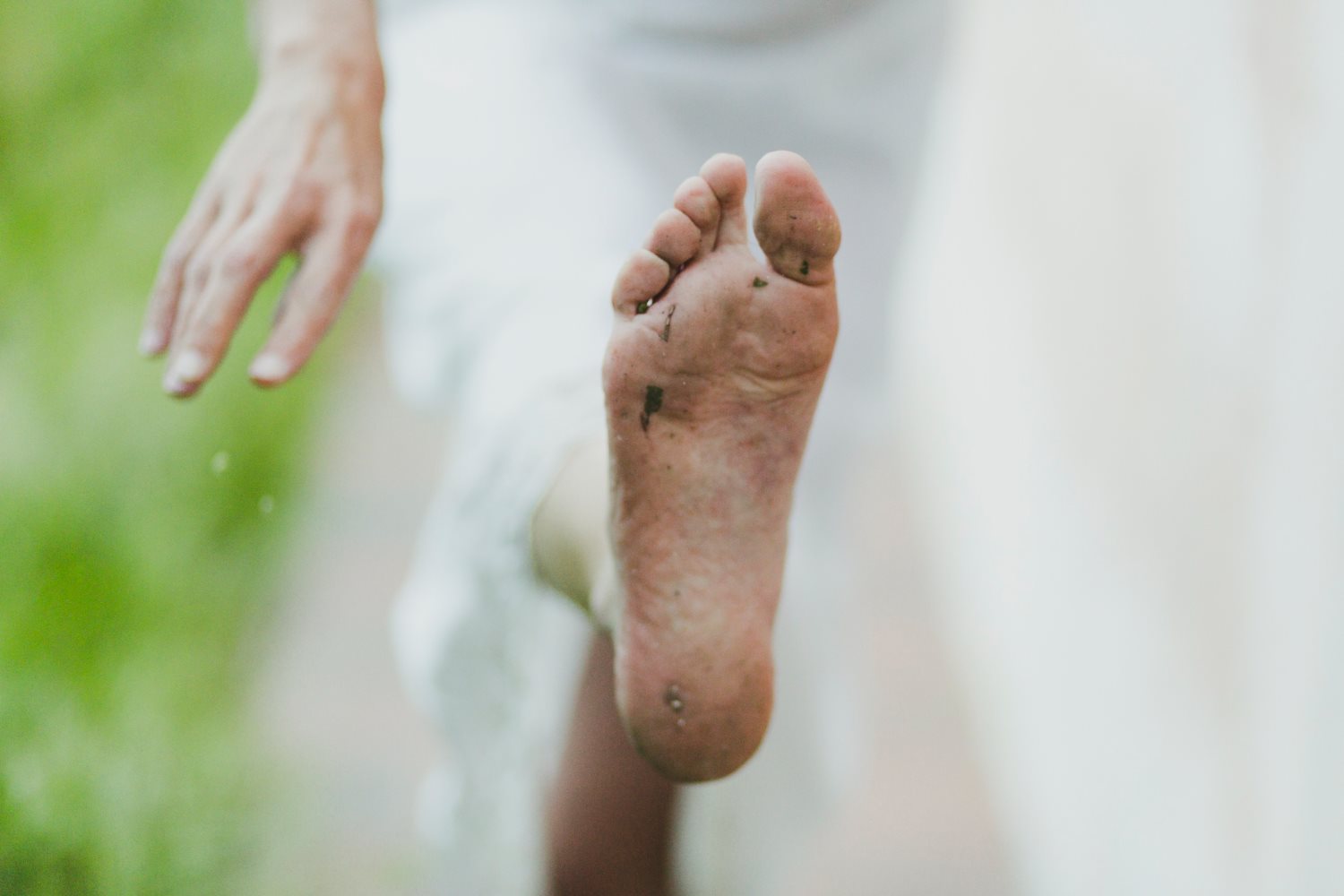 Corn and Calluses - What is the Difference and How Can They Be Treated?