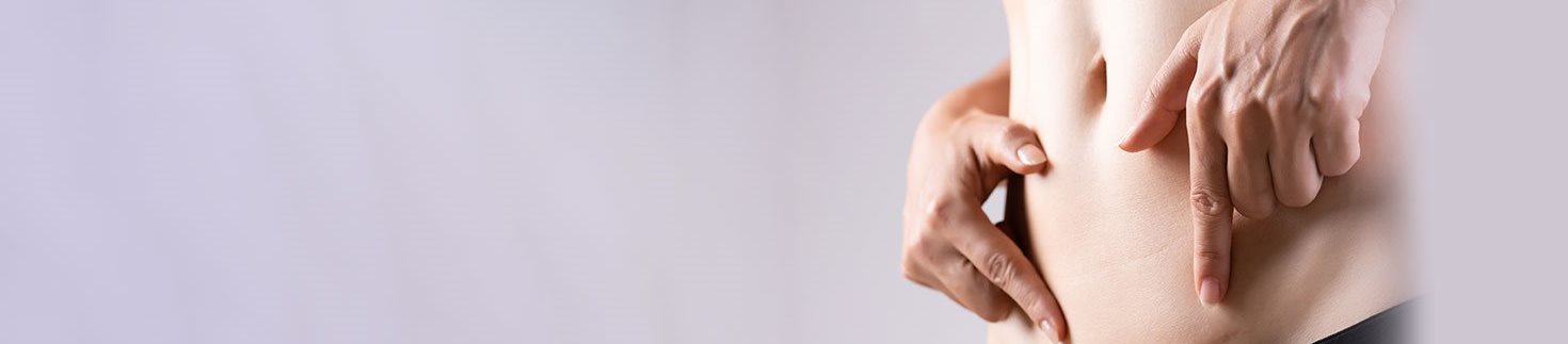 What are Scars? How to Minimize Scarring from Cuts and Wounds